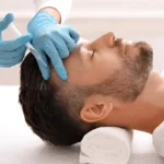 PRP Hair Treatment in Dubai