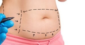 Waist Sculpting Treatment in Dubai1