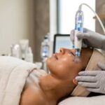 hydrodermabrasion facial Edmonton
