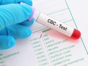 CBC-Blood-test-1024x768