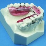 Dental Activators in Dubai5