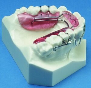 Dental Activators in Dubai5