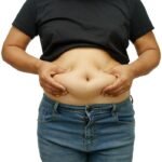 Fat Injections in Dubai1