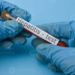 Hepatitis-Blood-Test-Price