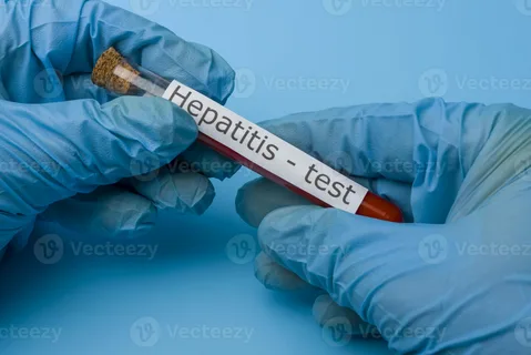 Hepatitis-Blood-Test-Price