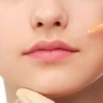 Hyaluronic Acid Injections in Dubai4