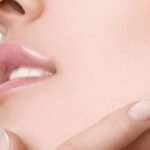 Lip Reduction in Dubai3