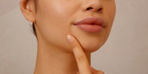 Lip Reduction in Dubai5