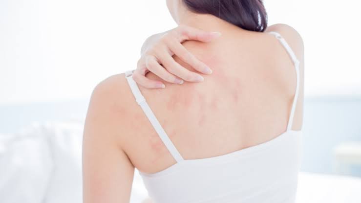 Skin Diseases Treatment in Dubai6
