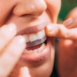 Teeth Whitening Strips in dubai3