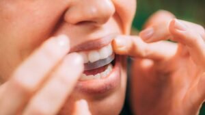 Teeth Whitening Strips in dubai3