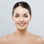 Under Eye Fillers in Dubai11