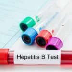 heppatitis-B.