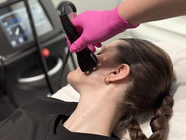 RF facial contouring Alberta