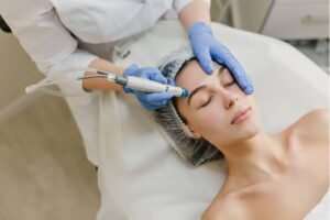 hydrodermabrasion facial edmonton