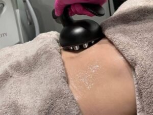 body contouring treatment Edmonton